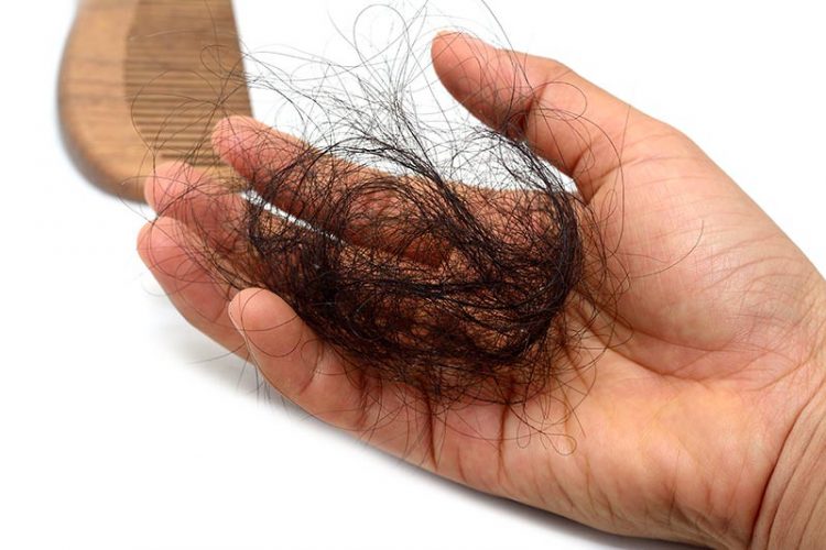 All you Should Know about Hair loss and Haircare