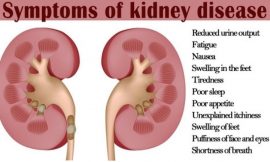 Kidney Disease – Symptoms and Causes