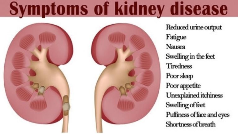 Kidney Disease - Symptoms and Causes