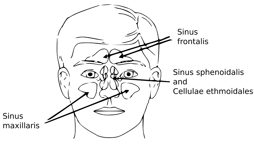 Sinusitis Remedies