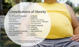 What is Obesity? Prevent Healthy Informatin