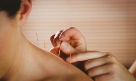 What is Acupuncture? Benefits for Health