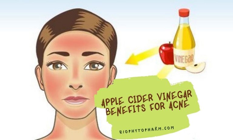Apple Cider Vinegar Benefits for Acne