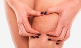 How to Get Rid of Cellulite Fast at Home