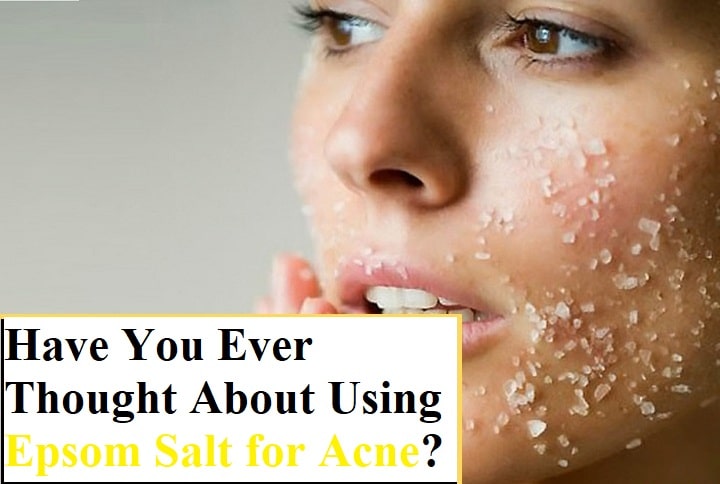 Have You Ever Thought About Using Epsom Salt for Acne