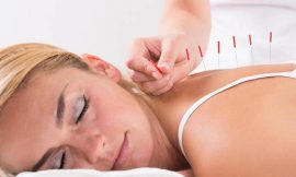 Side Effects of Acupuncture that You Must Know