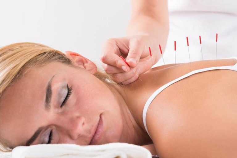 Side Effects of Acupuncture