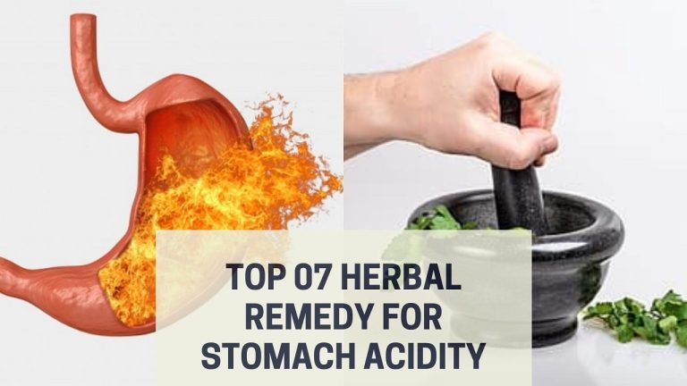 Top 07 Herbal Remedy for Stomach Acidity