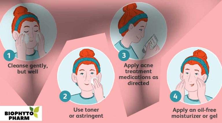 Daily Skin Care Routine for Oily Acne Prone Skin