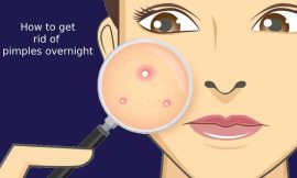 How to Get Rid of Pimples Overnight?