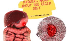 Knowing More About the Ulcer Diet
