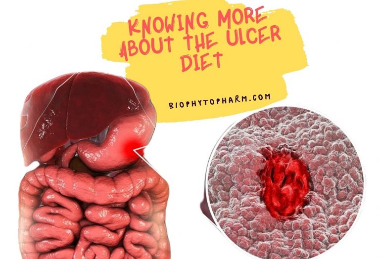 Knowing More About the Ulcer Diet