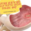 Sustain health and keep Peptic Ulcer Disease Away