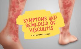 Symptoms and Remedies of Vasculitis