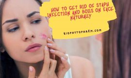 How to Get Rid of Staph Infection and Boils on Face Naturally