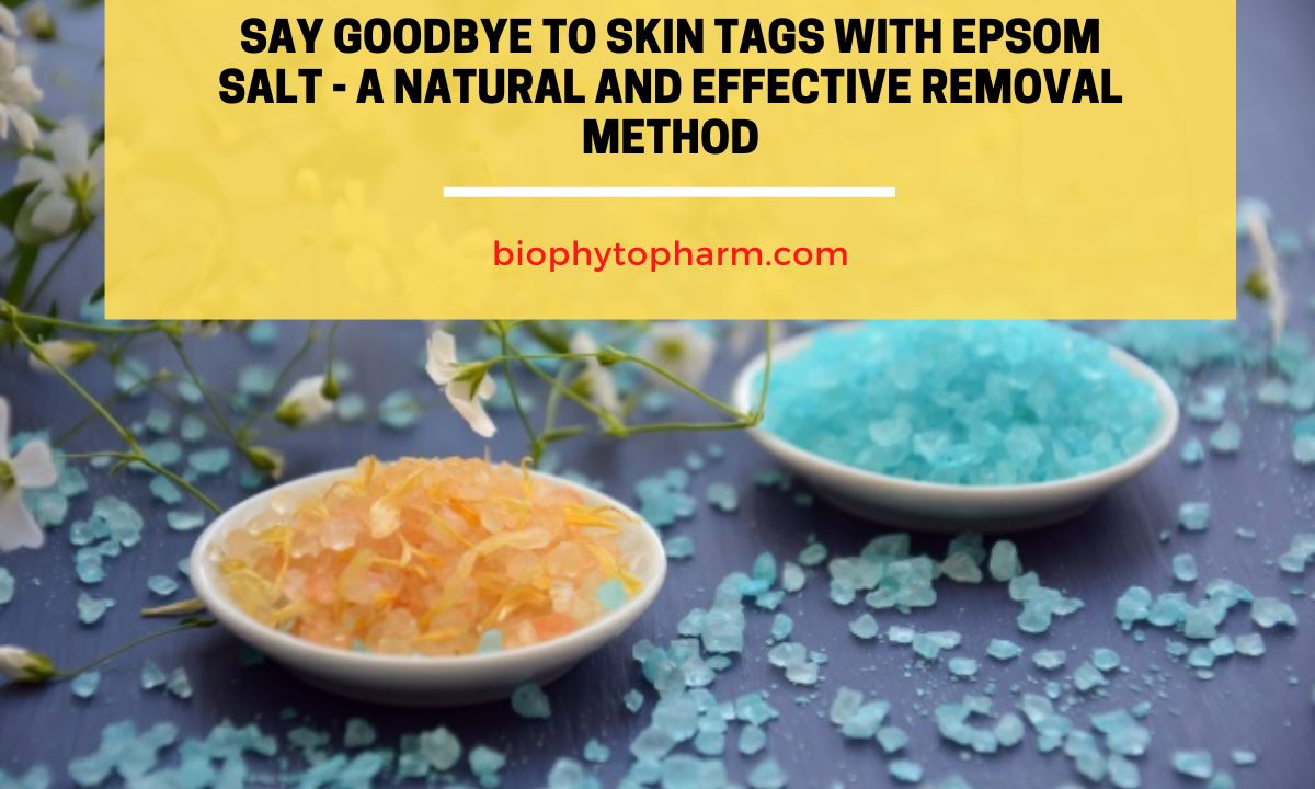 Say Goodbye to Skin Tags with Epsom Salt - A Natural and Effective Removal Method